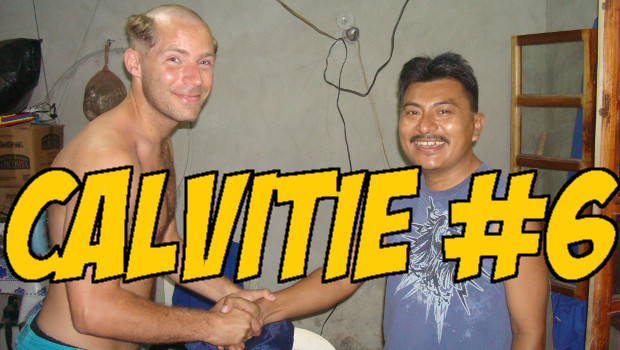 Calvitie #6 – EN VIDEO